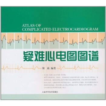 疑难心电图图谱 pdf epub mobi 电子书 下载